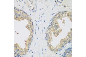 Immunohistochemistry of paraffin-embedded human prostate using ENPEP antibody (ABIN5975067) at dilution of 1/200 (40x lens). (ENPEP 抗体)