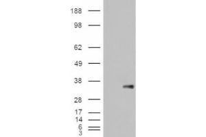 Western Blotting (WB) image for anti-WNT1 Inducible Signaling Pathway Protein 1 (WISP1) (C-Term) antibody (ABIN2466452) (WISP1 抗体  (C-Term))