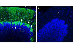 Expression of Beta 1 Na+/K+ ATPase in rat cerebellum.