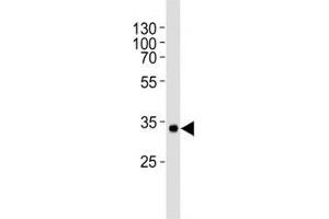Western blot analysis of human recombinant protein using vWF antibody at 1:1000. (VWF 抗体)