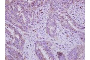 Image no. 1 for anti-Fatty Acid Desaturase 1 (FADS1) (AA 247-444) antibody (ABIN1498179) (FADS1 抗体  (AA 247-444))