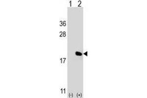 Western blot analysis of IL17A (arrow) using Interleukin-17A (IL17A) Antibody ; 293 cell lysates (2 ug/lane) either nontransfected (Lane 1) or transiently transfected (Lane 2) with the IL17A gene. (Interleukin 17a 抗体  (Middle Region))
