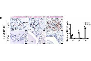 Infiltration of Cells and osteogenic differentiation MSCs around BCP dependent on T cells. (SETD7 抗体  (AA 1-366))