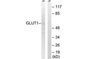 Western Blotting (WB) image for anti-Solute Carrier Family 2 (Facilitated Glucose Transporter), Member 1 (SLC2A1) (AA 441-490) antibody (ABIN2879123) (GLUT1 抗体  (AA 441-490))