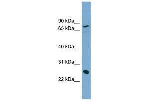 KLK5 antibody used at 1 ug/ml to detect target protein. (Kallikrein 5 抗体  (N-Term))