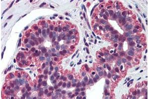 Human Breast (formalin-fixed, paraffin-embedded) stained with TP73 antibody ABIN298091 at 5 ug/ml followed by biotinylated anti-mouse IgG secondary antibody ABIN481714, alkaline phosphatase-streptavidin and chromogen. (Tumor Protein p73 抗体  (N-Term))