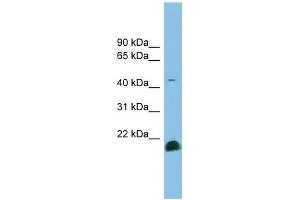 TGF beta 2 antibody used at 1 ug/ml to detect target protein. (TGFB2 抗体  (Middle Region))
