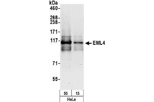 Western Blotting (WB) image for anti-Echinoderm Microtubule Associated Protein Like 4 (EML4) (AA 150-200) antibody (ABIN7454793) (EML4 抗体  (AA 150-200))