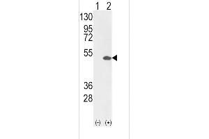 Western blot analysis of ETV4 (arrow) using rabbit polyclonal ETV4 Antibody (C-term) (R). (ETV4 抗体  (C-Term))