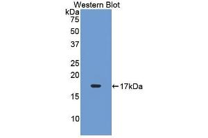 Detection of Recombinant LIFR, Rat using Polyclonal Antibody to Leukemia Inhibitory Factor Receptor (LIFR) (LIFR 抗体  (AA 152-291))