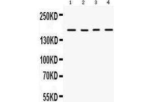 Anti-HKDC1 Picoband antibody, Western blotting All lanes: Anti HKDC1  at 0. (HKDC1 抗体  (N-Term))