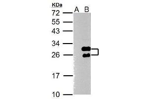 WB Image Twist1 antibody [N1C3] detects Twist1 protein by Western blot analysis. (TWIST1 抗体  (Center))