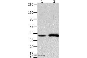 Western blot analysis of Mouse brain and  heart tissue, using FOXL2 Polyclonal Antibody at dilution of 1:750 (FOXL2 抗体)