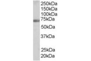 Image no. 1 for anti-Formin Binding Protein 1 (FNBP1) (Internal Region) antibody (ABIN374468) (FNBP1 抗体  (Internal Region))