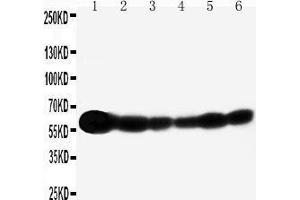 Anti-SHC antibody, Western blotting Lane 1: Rat Brain Tissue Lysate Lane 2: A549 Cell Lysate Lane 3: A431 Cell Lysate Lane 4: 293T Cell Lysate Lane 5: HELA Cell Lysate Lane 6: JURKAT Cell Lysate (SHC1 抗体  (C-Term))