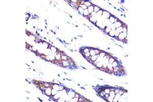 Immunohistochemistry of paraffin-embedded human colon using HSP47/SERPINH1 Rabbit mAb (ABIN7270238) at dilution of 1:100 (40x lens). (SERPINH1 抗体)