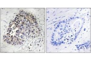 Immunohistochemistry (IHC) image for anti-Cytochrome P450, Family 2, Subfamily S, Polypeptide 1 (CYP2S1) (AA 181-230) antibody (ABIN1534391)