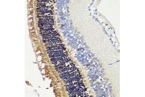 Immunohistochemistry of paraffin-embedded mouse retina using RCVRN antibody (ABIN6128676, ABIN6146832, ABIN6146833 and ABIN6222036) at dilution of 1:200 (40x lens). (Recoverin 抗体  (AA 1-200))