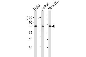 Western blot analysis of lysates from Hela, Jurkat, mouse NIH/3T3 cell line (from left to right), using ARA Antibody (ABIN1944858 and ABIN2838532). (PPARA 抗体  (AA 1-468))