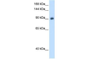 WB Suggested Anti-NR3C2 Antibody Titration:  1. (NR3C2 抗体  (Middle Region))