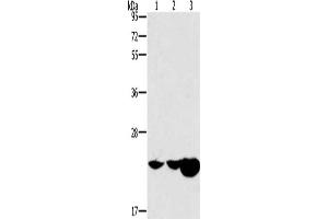 Gel: 10 % SDS-PAGE, Lysate: 40 μg, Lane 1-3: Mouse kidney tissue, Mouse liver tissue, human fetal liver tissue, Primary antibody: ABIN7191000(HRASLS2 Antibody) at dilution 1/362. (HRASLS2 抗体)