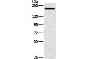 Western blot analysis of Hela cell, using NCOA3 Polyclonal Antibody at dilution of 1:200 (NCOA3 抗体)