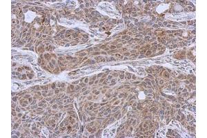 IHC-P Image Immunohistochemical analysis of paraffin-embedded Cal27 xenograft, using DLST, antibody at 1:500 dilution.