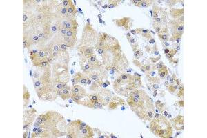 Immunohistochemistry (Paraffin-embedded Sections) (IHC (p)) image for anti-Centrin, EF-Hand Protein, 3 (CETN3) antibody (ABIN7264157)