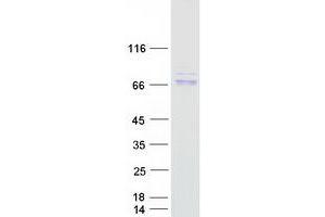 Western Blotting (WB) image for Apoptosis-Inducing Factor, Mitochondrion-Associated, 1 (AIFM1) (Transcript Variant 1) protein (Myc-DYKDDDDK Tag) (ABIN2714484)