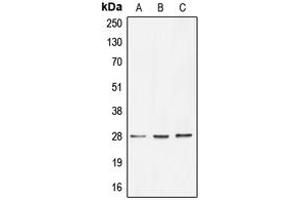 Western blot analysis of BRMS1 expression in HT29 (A), HeLa (B), MCF7 (C) whole cell lysates. (BRMS1 抗体  (Center))