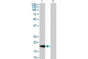 Western Blot analysis of DUSP22 expression in transfected 293T cell line by DUSP22 monoclonal antibody (M01), clone 3D3. (DUSP22 抗体  (AA 112-184))