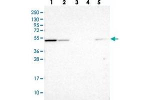 Western blot analysis of Lane 1: RT-4, Lane 2: U-251 MG, Lane 3: Human Plasma, Lane 4: Liver, Lane 5: Tonsil with NSUN7 polyclonal antibody  at 1:100-1:250 dilution. (NSUN7 抗体)