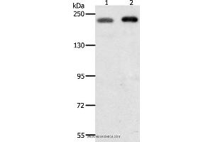 Western blot analysis of Hela and Jurkat cell, using SMARCA4 Polyclonal Antibody at dilution of 1:700 (SMARCA4 抗体)