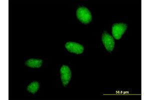 Immunofluorescence of monoclonal antibody to UBE2C on HeLa cell. (UBE2C 抗体  (AA 1-179))