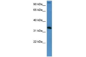 WB Suggested Anti-HADH Antibody Titration: 0. (HADH 抗体  (Middle Region))