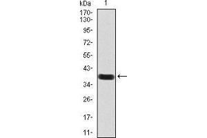 Western blot analysis using PAX6 mAb against human PAX6 (AA: 1-122) recombinant protein. (PAX6 抗体  (AA 1-122))