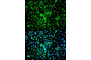 Immunofluorescence analysis of A549 cell using CIDEA antibody. (CIDEA 抗体)