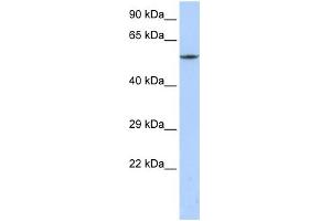 WB Suggested Anti-CACNB1 Antibody Titration:  0. (CACNB1 抗体  (C-Term))