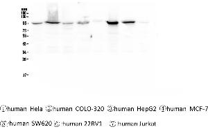 Western blot analysis of beta Catenin using anti-beta Catenin antibody .