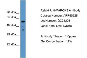 Western Blotting (WB) image for anti-Myristoylated Alanine-Rich Protein Kinase C Substrate (MARCKS) (C-Term) antibody (ABIN786131) (MARCKS 抗体  (C-Term))