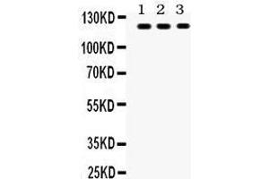 Anti- TLR7 Picoband antibody, Western blotting All lanes: Anti TLR7  at 0.