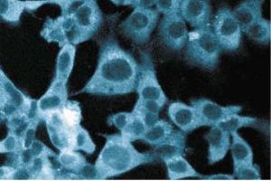 Immunofluorescent staining of ES2 cells. (STRAP 抗体  (AA 42-154))
