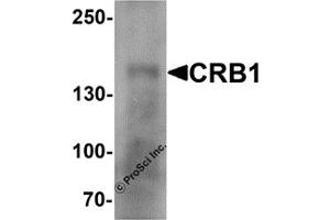 Western Blotting (WB) image for anti-Crumbs Homolog 1 (CRB1) antibody (ABIN1077415) (CRB1 抗体)