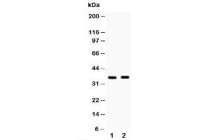 Western blot testing of HSD17B6 antibody and Lane 1:  human placenta;  2: MCF-7;  Predicted size: 35KD;  Observed size: 35KD (HSD17B6 抗体  (C-Term))