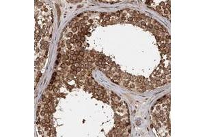 Immunohistochemical staining of human testis with FAXC polyclonal antibody  shows strong cytoplasmic positivity in cells in seminiferus ducts at 1:200-1:500 dilution. (C6orf168 抗体)