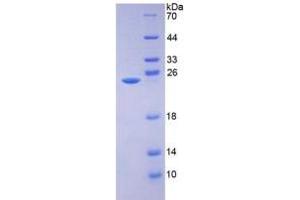 SDS-PAGE of Protein Standard from the Kit (Highly purified E. (AMBP ELISA 试剂盒)