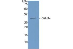 Detection of Recombinant AMY2, Human using Polyclonal Antibody to Amylase, Alpha 2A (AMY2A) (AMY2A 抗体  (AA 188-432))