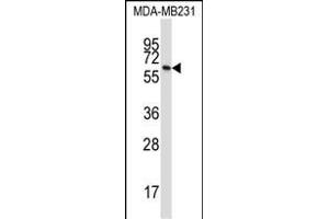 BTN3A1 Antibody (C-term) (ABIN657422 and ABIN2846459) western blot analysis in MDA-M cell line lysates (35 μg/lane). (BTN3A1 抗体  (C-Term))