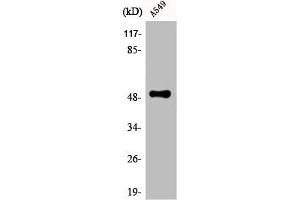 Western Blot analysis of A549 cells using CPM Polyclonal Antibody (CPM 抗体  (Internal Region))
