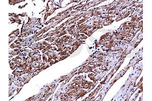Formalin-fixed and paraffin embedded mouse heart tissue with Anti-CTn1/Troponin I/TNNC1 Polyclonal Antibody, Unconjugated (ABIN728308) at 1:200, followed by conjugation to the secondary antibody and DAB staining (TNNC1 抗体  (AA 131-210))